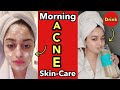 Morning skin care routine for oily  acne prone skin  antiacne drink  shorts youtubeshorts