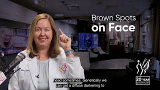 What Are Brown Spots On Face? Brown Spots On Aging Face 2020
