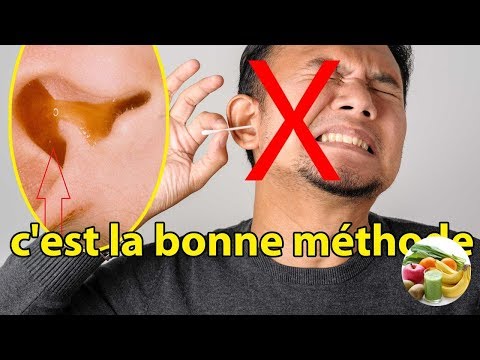 Vidéo: Remède à La Maison Pour Enlever Le Cérumen: Nettoyez Vos Oreilles En Toute Sécurité