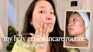 my holy grail skincare routine | healing severe acne scarring, texture and hyperpigmentation