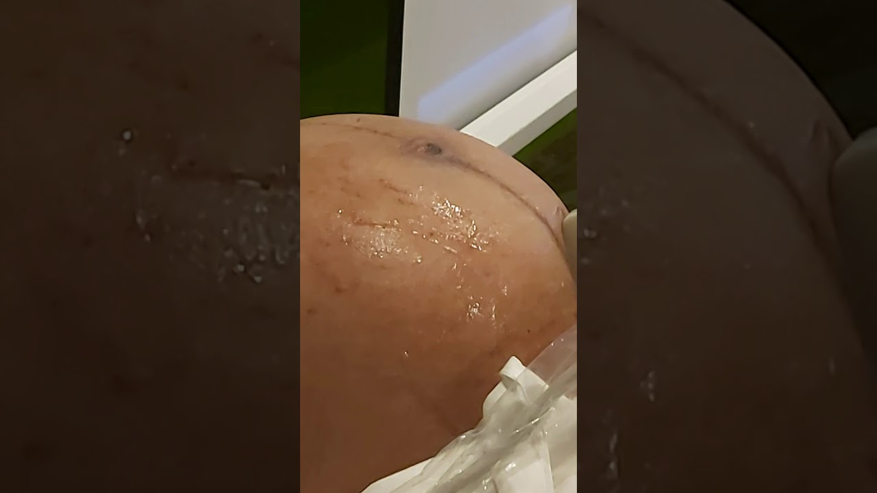 Pelatihan USG ANC mindray dp 10