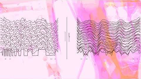 Wavparty - Pico Drum2 sample pack