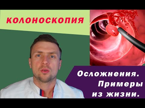 Колоноскопия. Осложнения. Примеры.