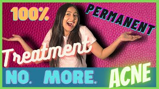 Best Acne Treatment पिम्पल्स हटाने का तरीका Reduce Pimples | Permanent Solution for Clear Skin