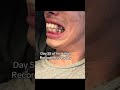 day55