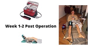 Week 1-2 Update Hip Arthroscopy Torn Labrum Fai