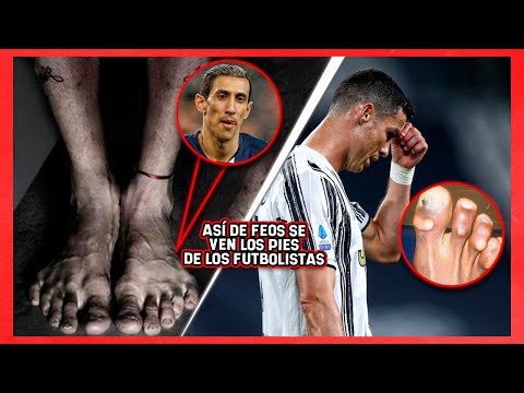 ASÍ DE FEOS se ven los PIES DE LOS FUTBOLISTAS más famosos ¡Esta es la ESCALOFRIANTE RAZÓN!