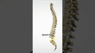 Lumbar disectomy procedure 3D Animation #doctor #epic #facts #hospital #science #surgery #medical