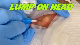 Husband of Bumpy - Nice Extraction! NEW