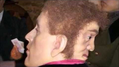 Edward Mordake   The man with two faces