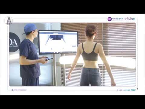 가슴성형 3D스캐너 가상성형 시스템 디에이성형외과 X 모티바 디비나[Motiva Divina System]