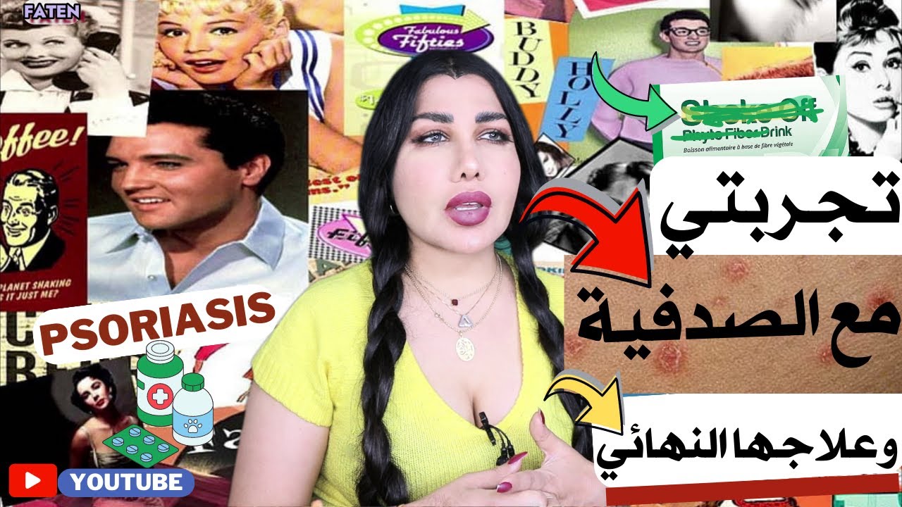 ⚠️علاج بسيط للصدفية او الاكزيما💉مرحلة عصيبة ولكن تخطيتها #فاتن_عبدالحميد #الصدفية #علاج #2023 #ترند