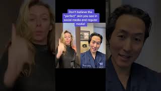 Perfect Skin Is A Myth