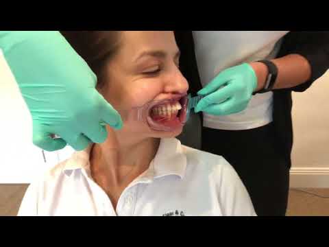 clinical-orthodontic-photography-demo-by-boss-and-dr-katyal