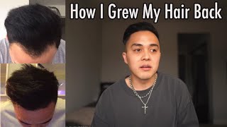 How I Grew My Hair Back  | My Hair Loss Journey and Treatment