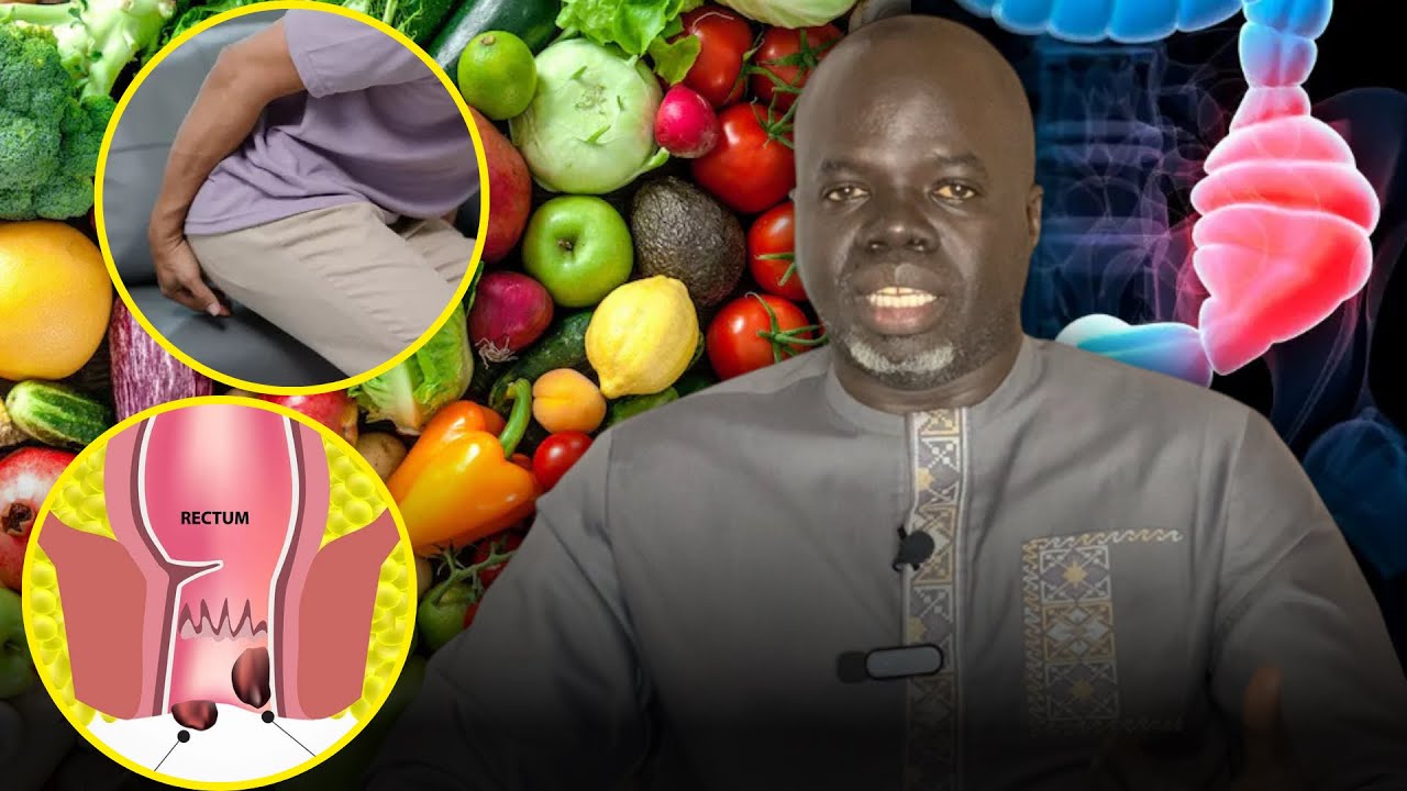 Hémorroïde - ( Préventions et Solutions ) - Pr Ousmane Ndiaye - SAMA XALAAT TV