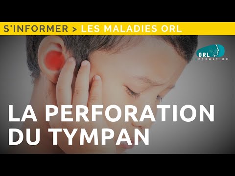 Vidéo: Écoulement Auriculaire: Causes, Traitements Et Prévention