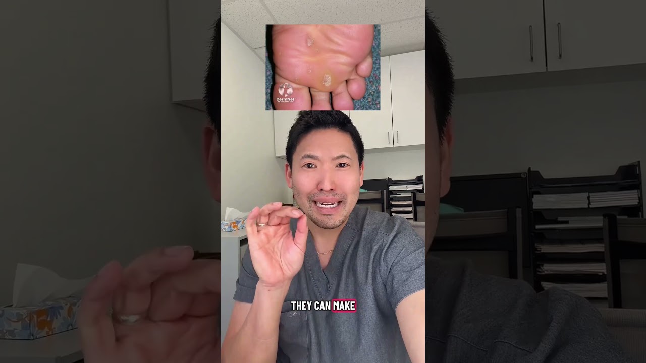 Should Employees Come to Work Barefooted?