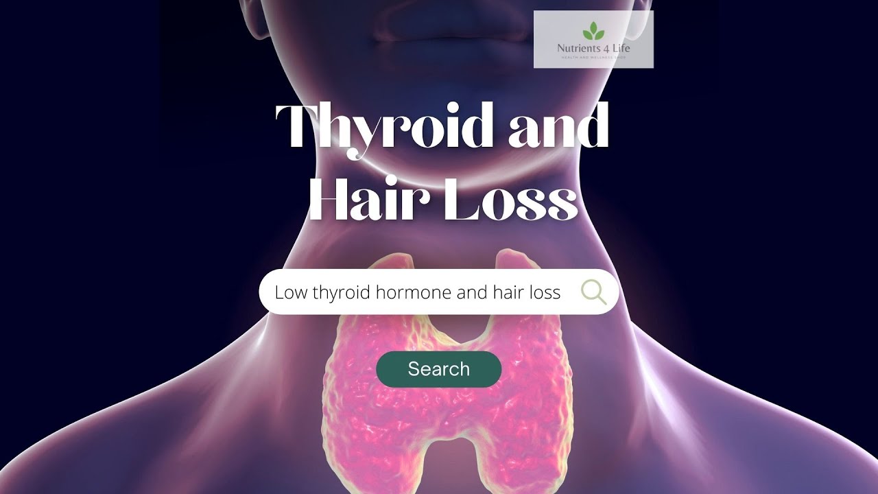Low Thyroid Hormone and Hair Loss - YouTube