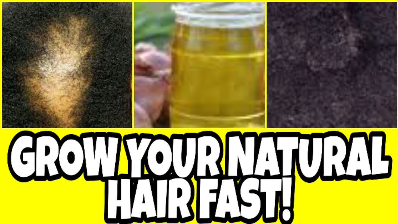 Use this OIL to REGROW your BALD SPOTS IN 2 WEEKS* YOUR NATURAL HAIR