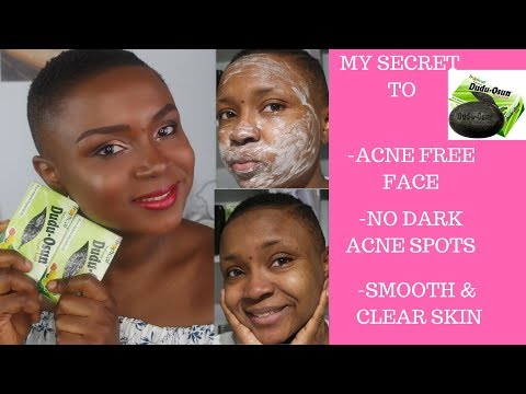 DUDU OSUN AFRICAN BLACK SOAP/ SUPER CLEAR & ACNE FREE FACE SOAP/ MY HOLY GRAIL TO NO ACNE