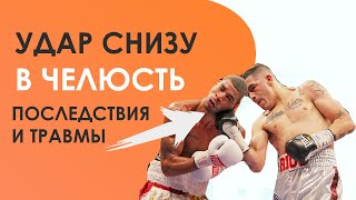 Удар СНИЗУ в челюсть (Апперкот): Травмы, последствия