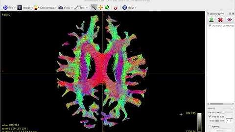 Whole-brain tractography on the HCP example data using MRtrix3