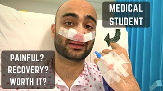 Underwent surgery 3 days before med school finals | Septoplasty VLOG + Advice