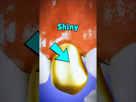 Gold Tooth Danger UnbelievableFacts WeirdHealth