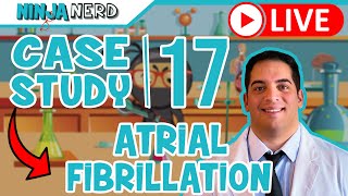 Case Study #17: Atrial Fibrillation