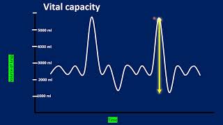 Spirogram Spirometer Lung Volume And Capacities Explained In Detail--- Respiratory System