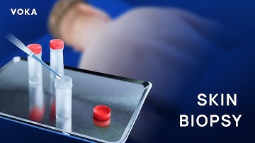 Skin Biopsy Procedure: Punch, Shave, and Excisional Biopsy in 3D Animation | Dermatology