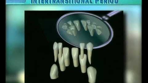 Clip 10: Transition of Mandibular Incisors with Excess of Space