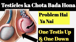 Testicles ka Chota Bada Hona problem hai ya Nai ||One testicle up & one down