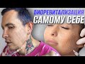 БИОРЕВИТАЛИЗАЦИЯ самому себе | Как я делаю себе инъекции #самсебекосметолог #биоревитализация