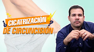 ¿Cuánto dura el procedimiento de circuncisión?