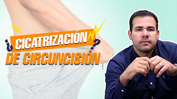 ¿Cuánto tiempo tarda en cicatrizar completamente la circuncisión?