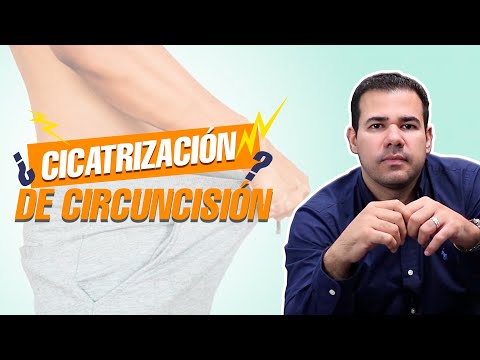Video: ¿Cuánto tardará en sanar la circuncisión?