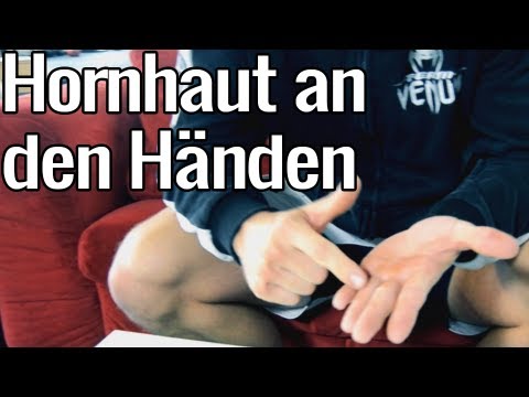 Video: Vorbeugung Und Kontrolle Von Schwielen An Den Händen