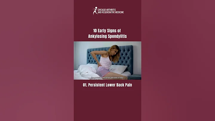 Persistent lower back pain | 10 Early Signs of Ankylosing Spondylitis You Shouldn’t Ignore!