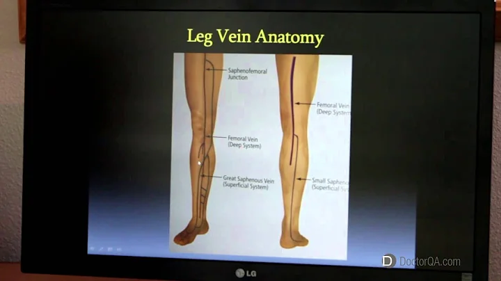 How do your veins work? - Dr. David Ellertson Sr.,...