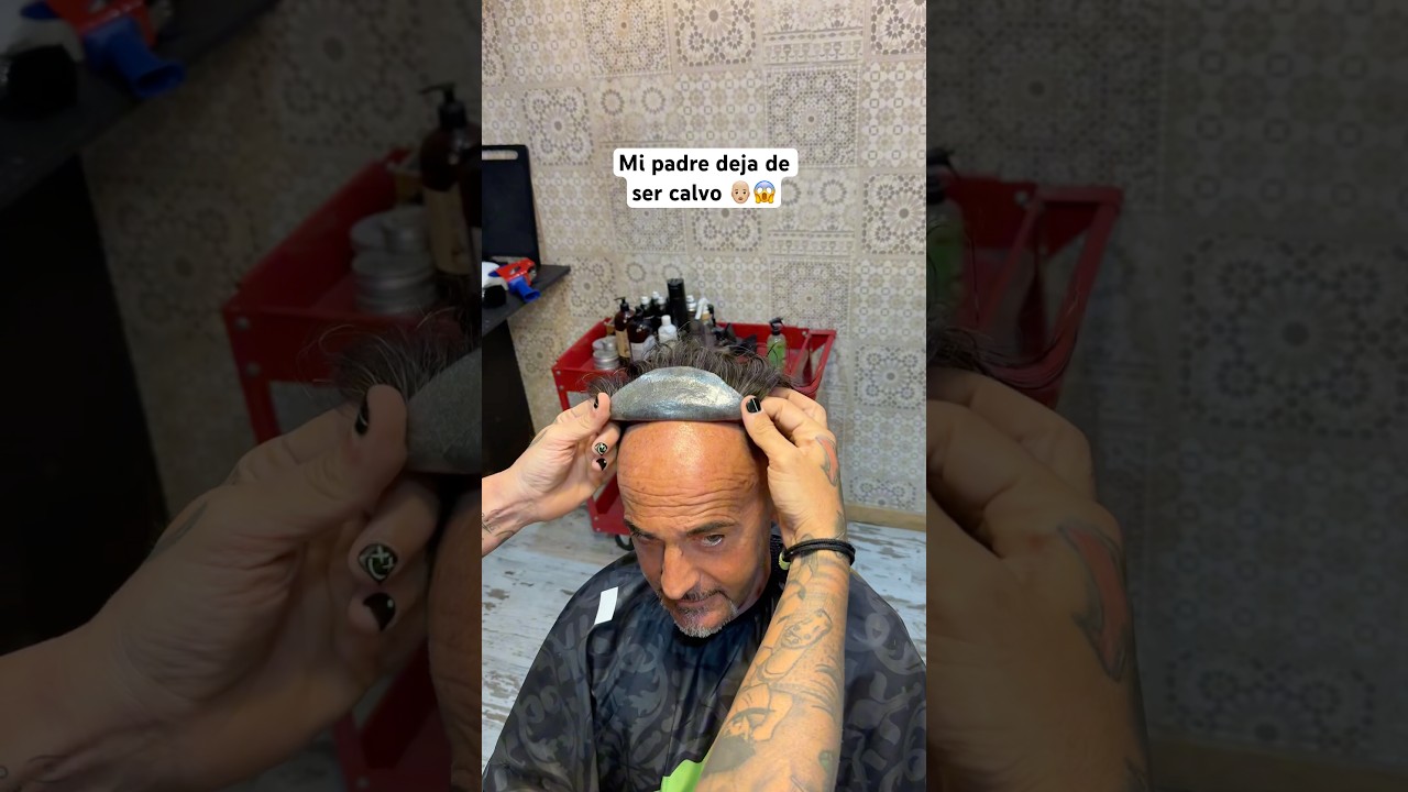 Mi padre se pone pelo por primera vez #peluqueros #protesiscapilar #injerto