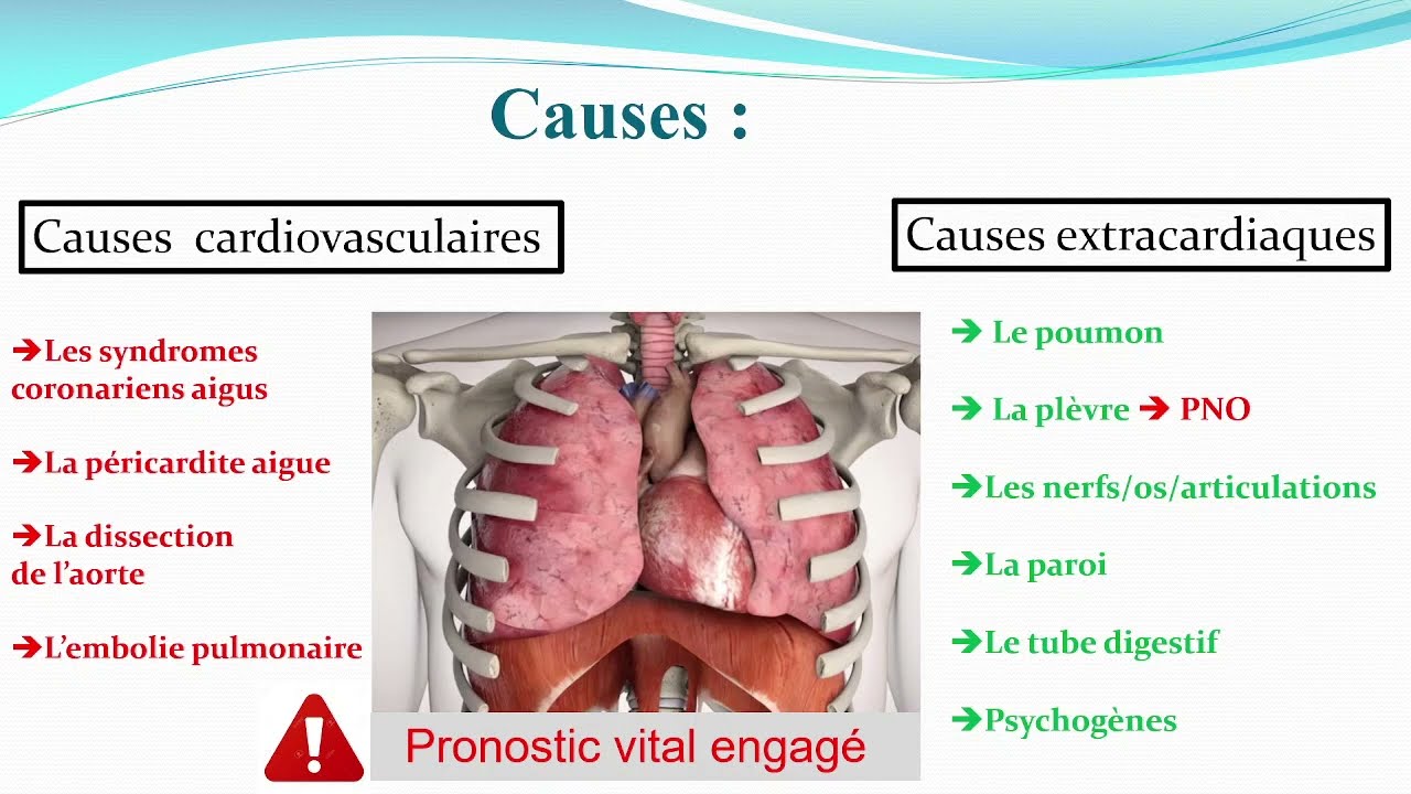#UMC | 12.Douleurs thoraciques (Dr Metali)