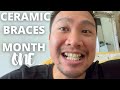 Braces Journal | My Ceramic Braces | Month One | 5 Things I Learned