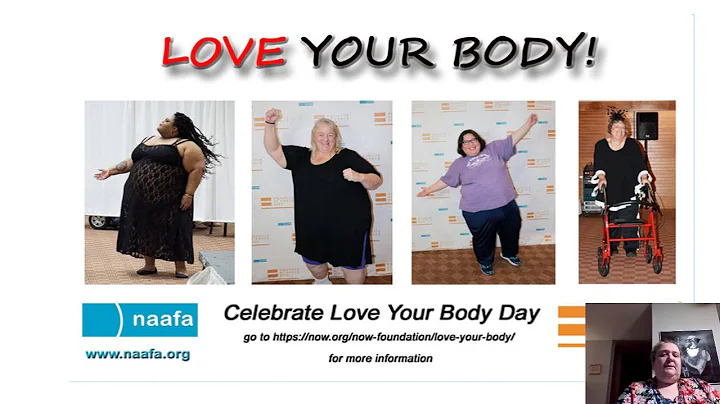 Lipedema and Disability Self-Advocacy, Lisa Quinlan