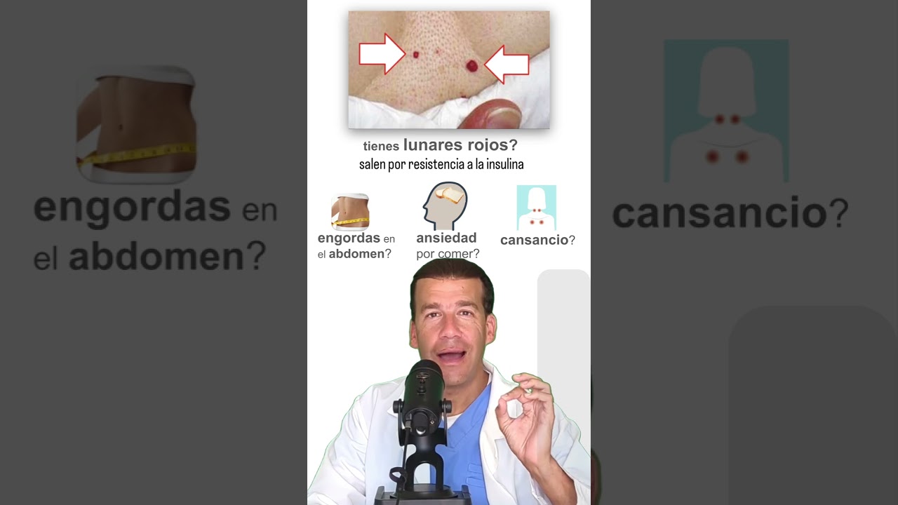 Cómo calcular la resistencia a la insulina.