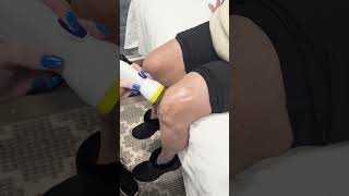 SoftWave Therapy for Knee Pain Relief! 🦵✨ #KneePainRelief #SoftWaveTherapy