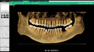 Vatech [Ez3D-i] - 3D PAN Tab 01 : Manipuler la 3D