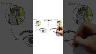 Understand Your Cataract Lens Options