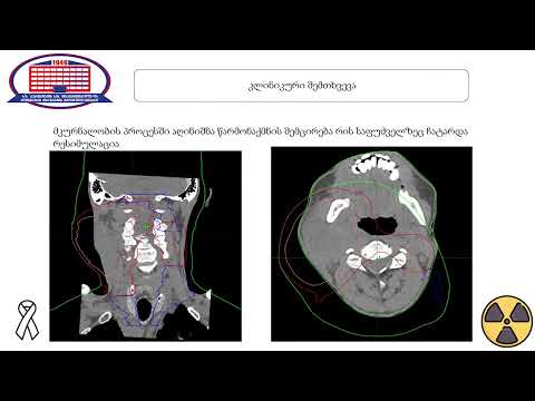 ონკოლოგი , ანა გოდელაშვილი